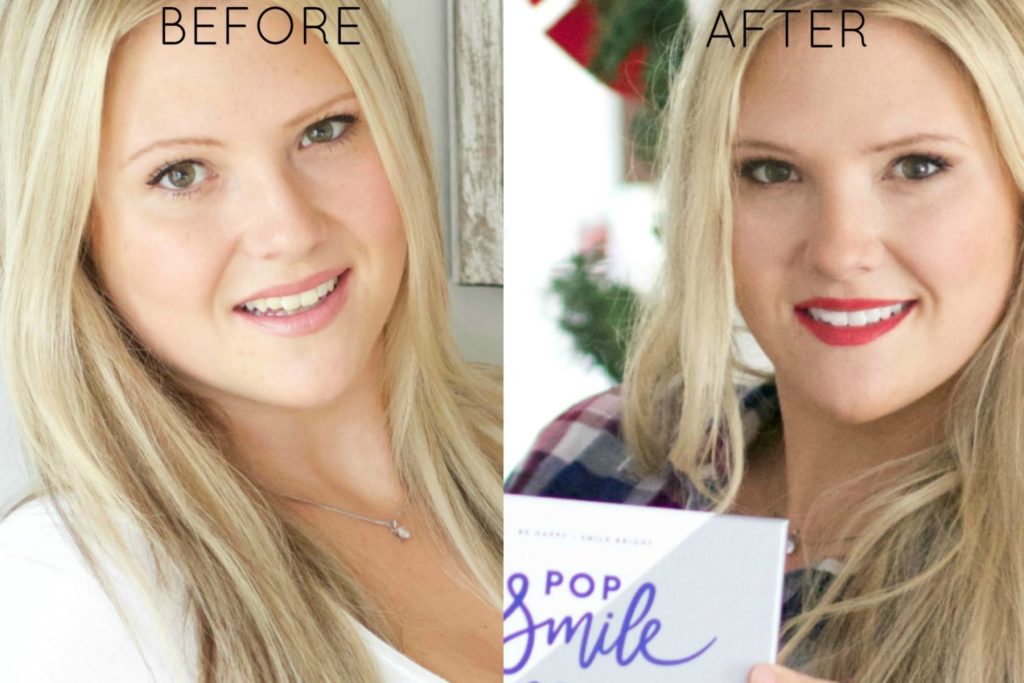 How to Get Whiter and Brighter Teeth Naturally (Pop Smile Review)