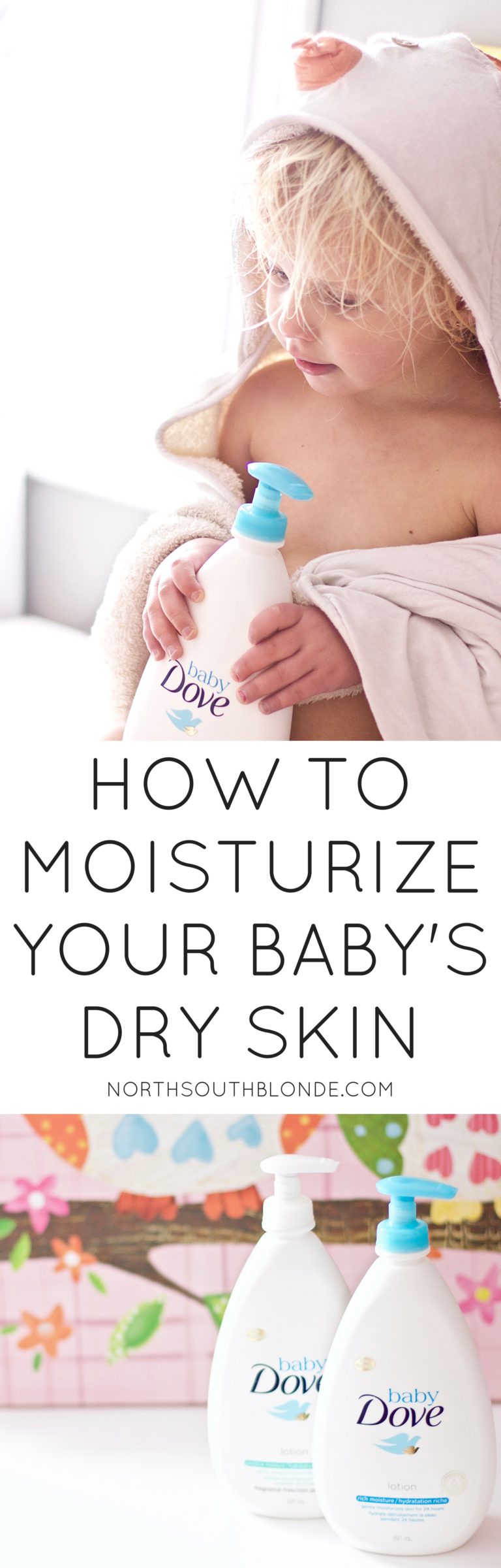 How to Moisturize Your Baby's Dry Skin with Baby Dove